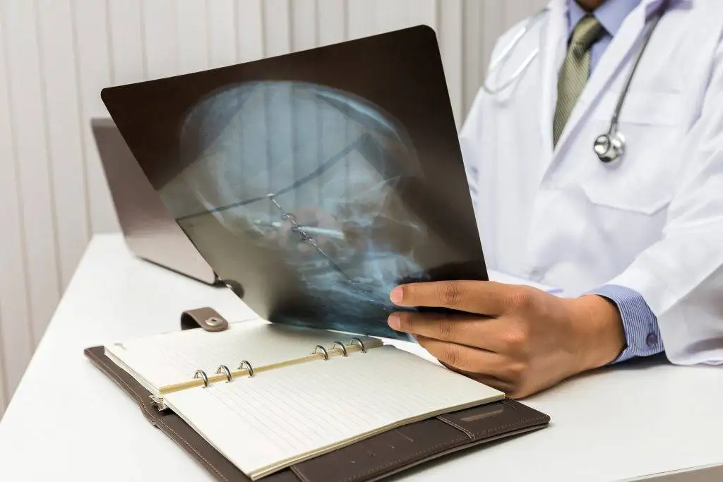 Head X-ray due to head injury