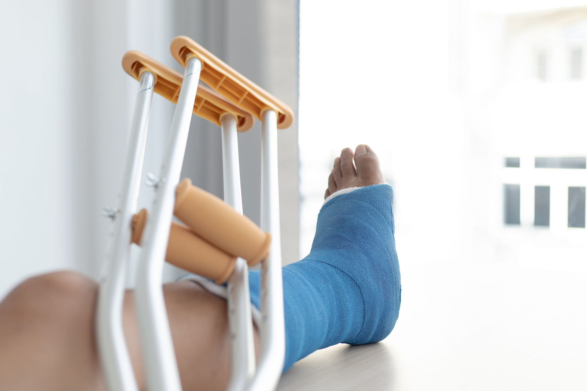 Leg injury due to slip and fall accident