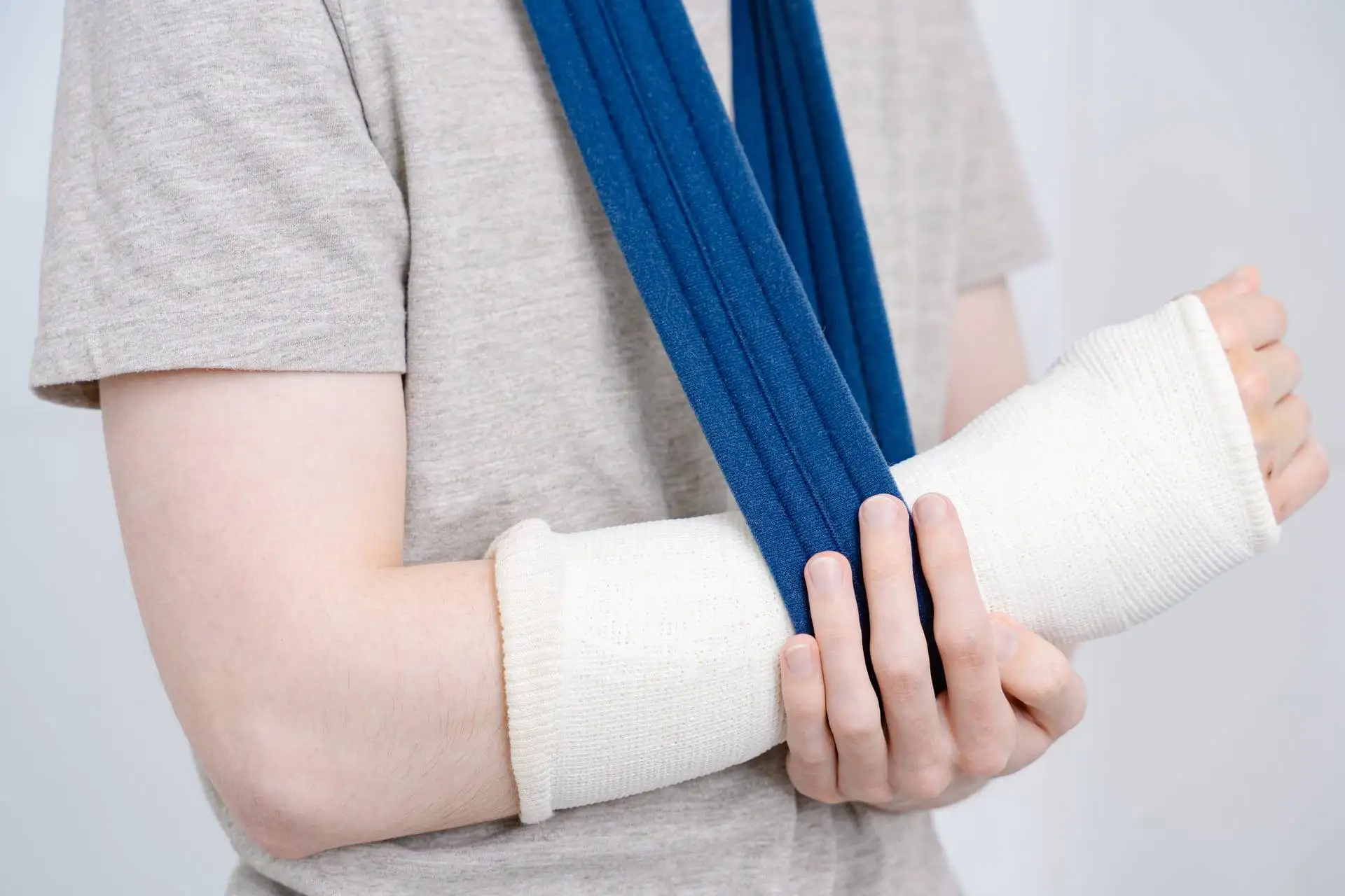 Close-up of a broken arm in a white cast with a blue sling