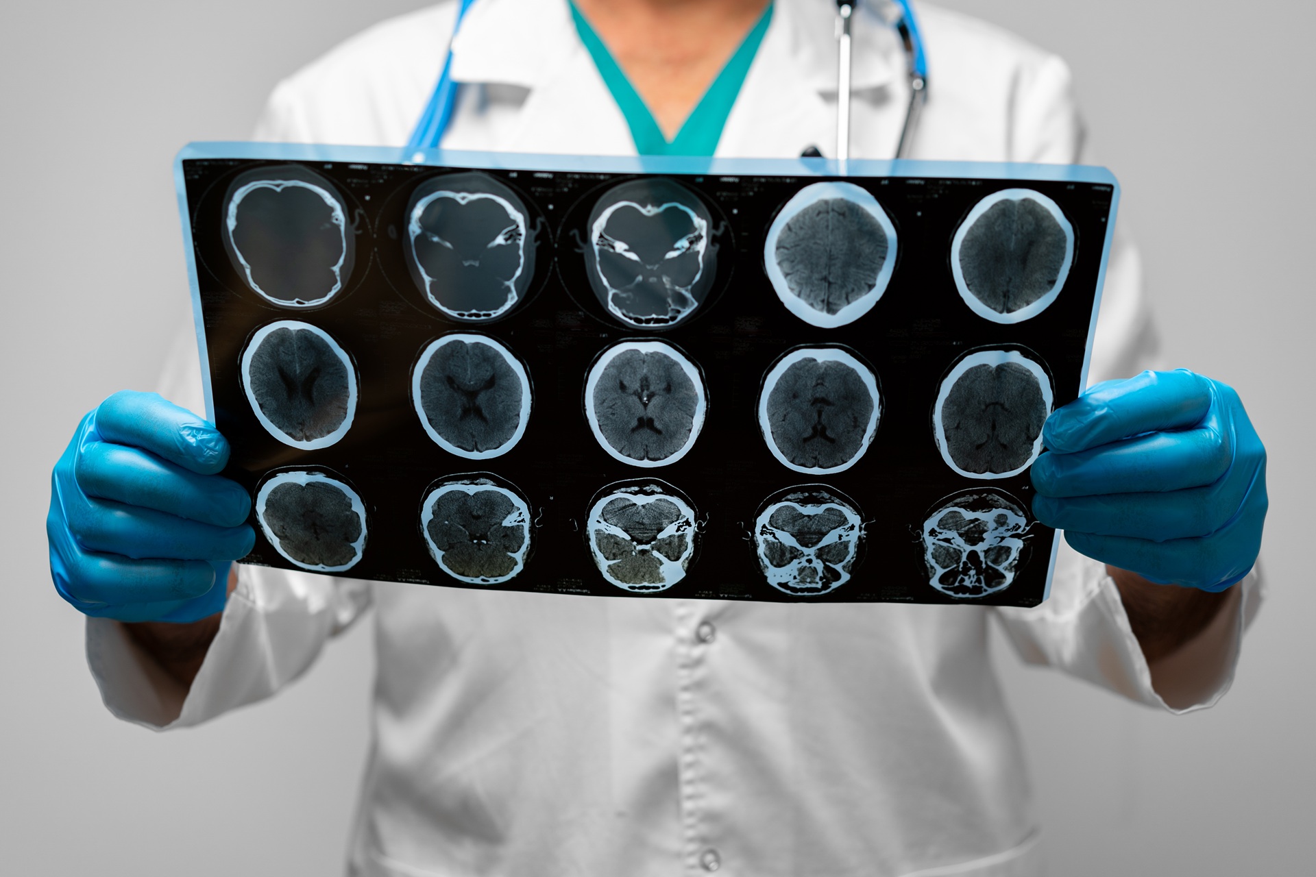 Hands of a doctor holding head mri scan
