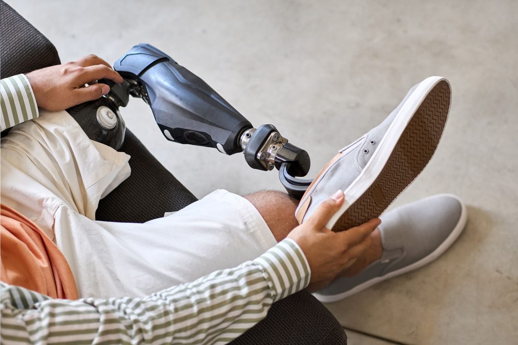 amputee putting shoe on prosthetic leg