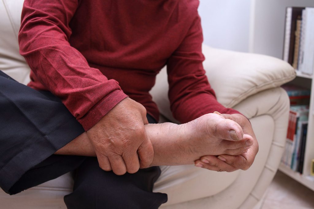 a man sat down holding the side of his foot