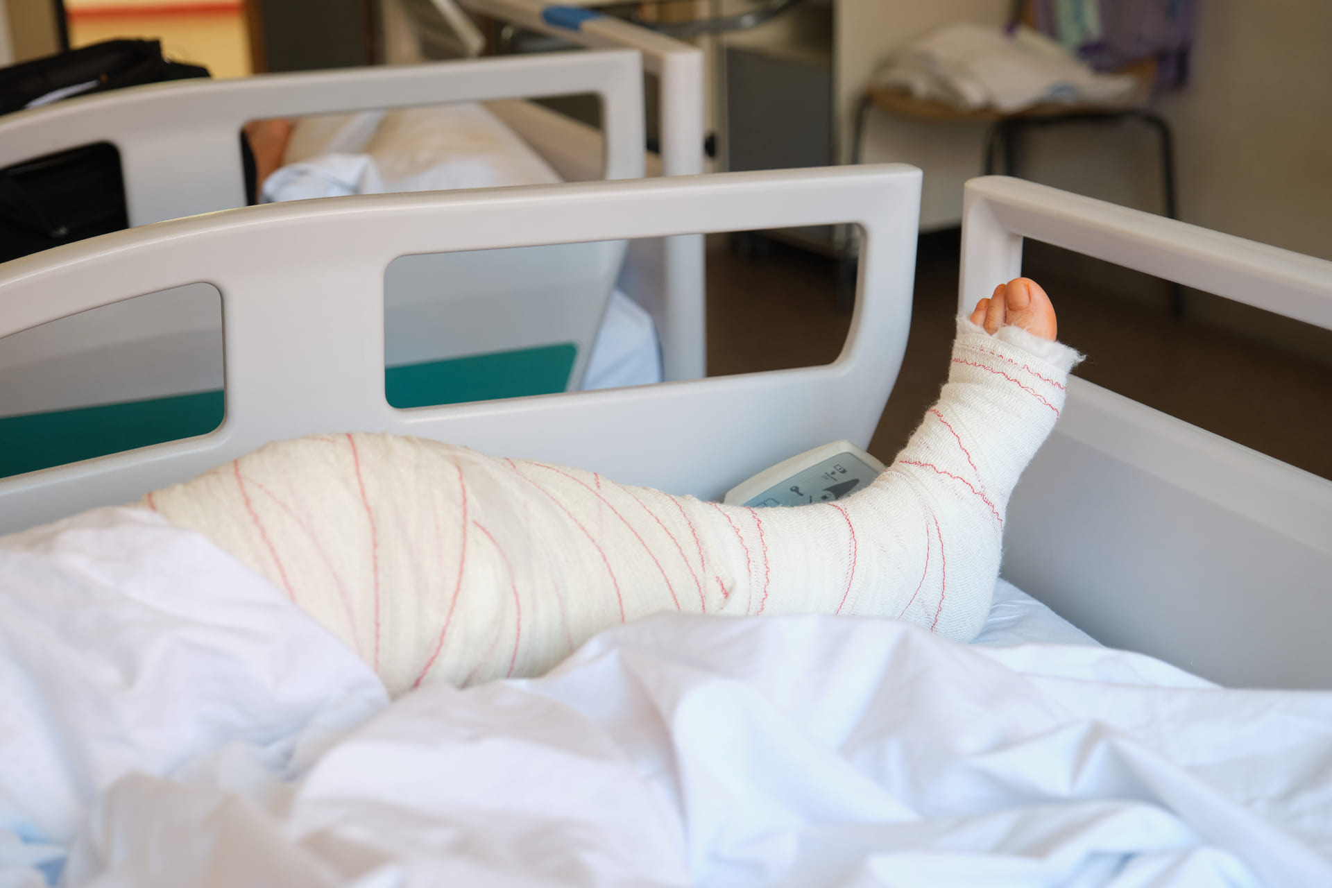 picture of broken leg