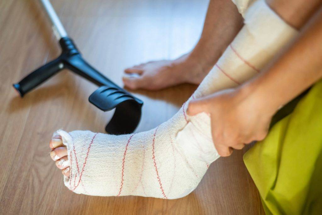 pIcture of a wounded leg from a slip and fall accident