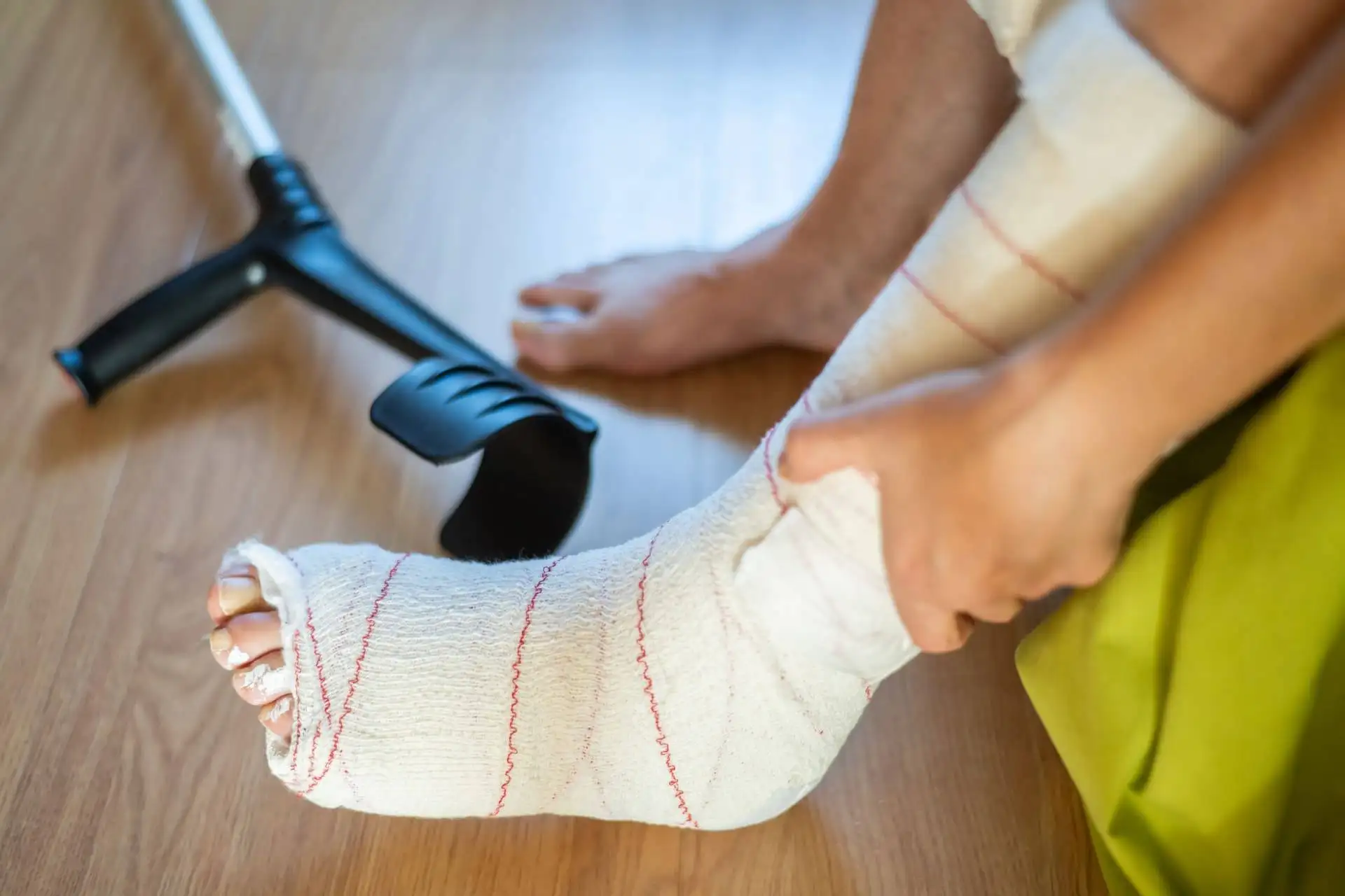 pIcture of a wounded leg from a slip and fall accident