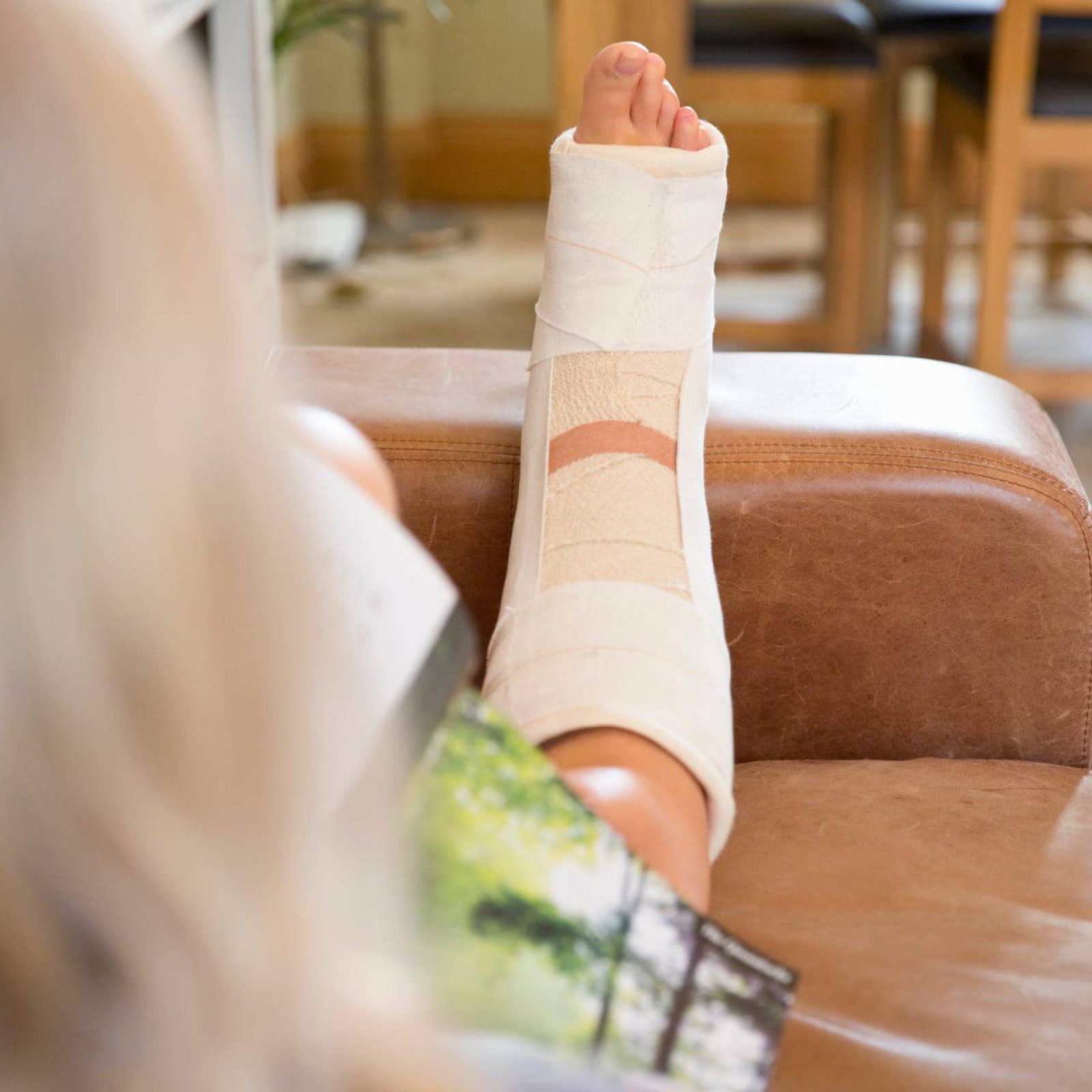 woman with leg in plaster cast