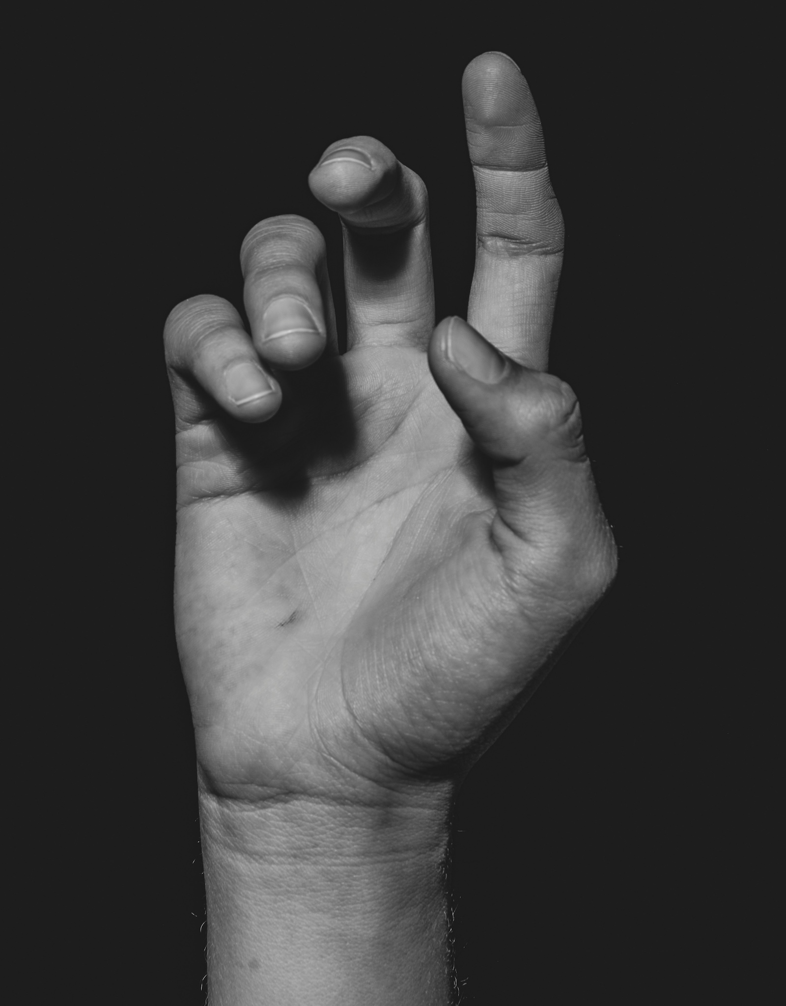 Los Angeles CRPS Lawyer | Free Consultation