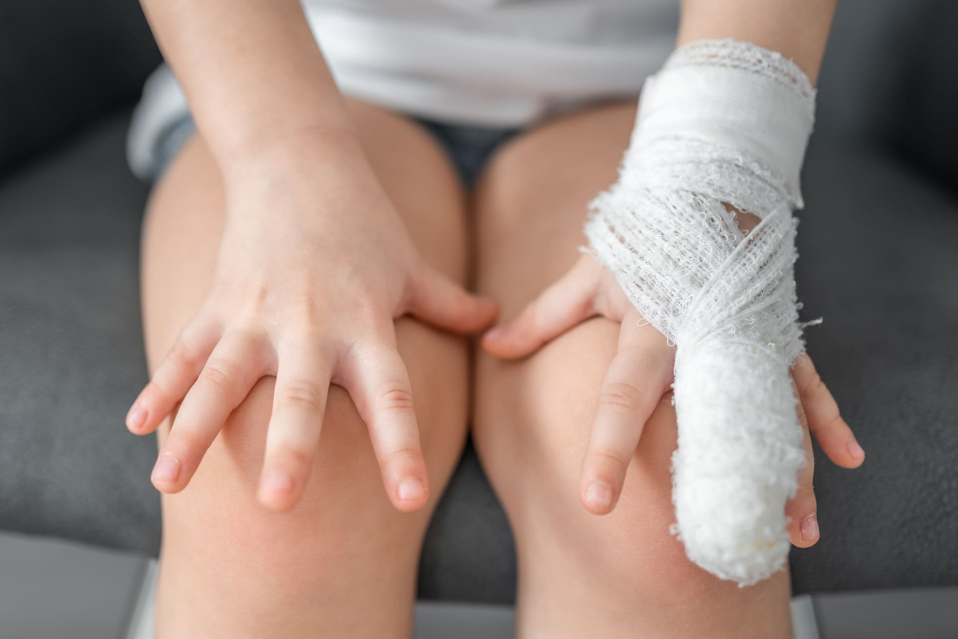 young woman with battered hand