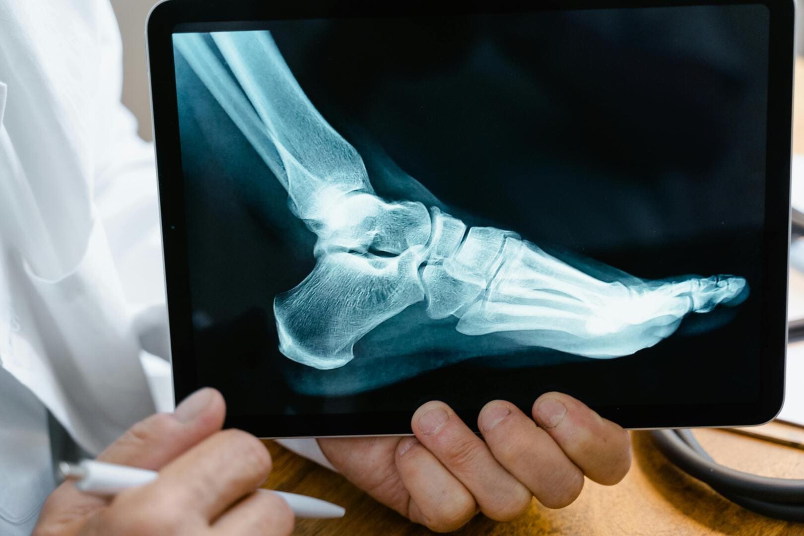 Doctor Holding X-ray Image of Broken Leg