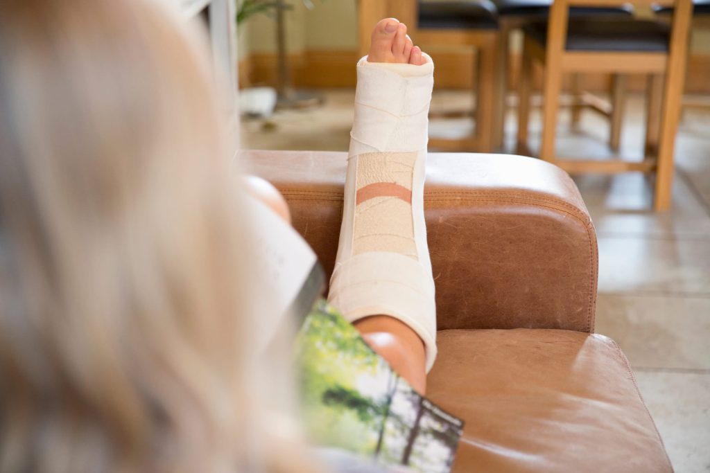woman with leg in plaster cast
