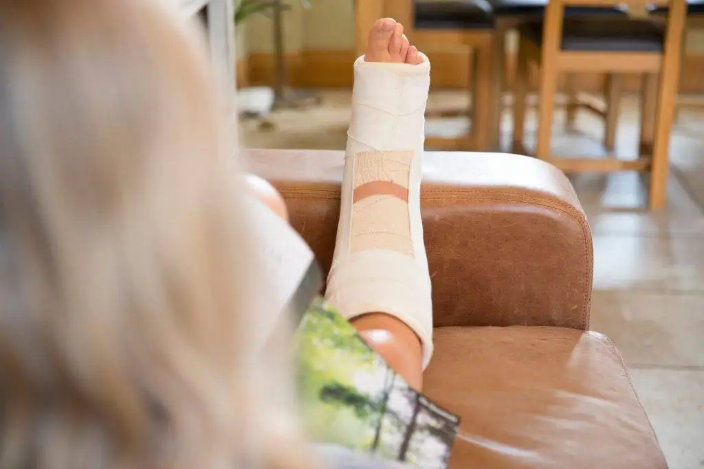 woman with leg in plaster cast